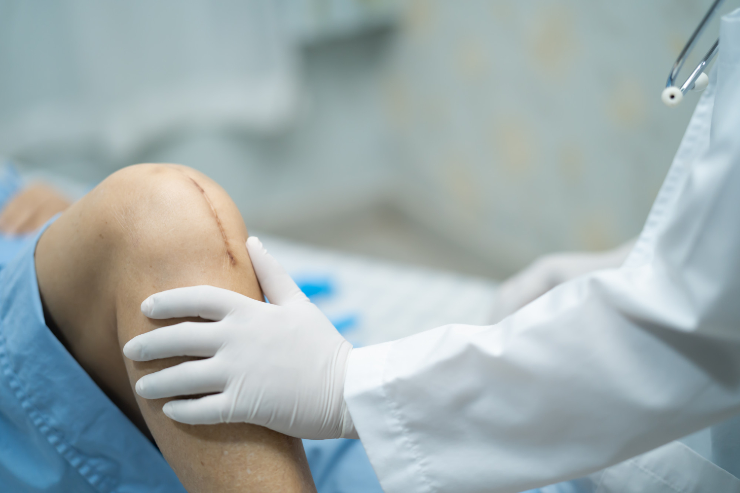 Joint Replacement Surgery
