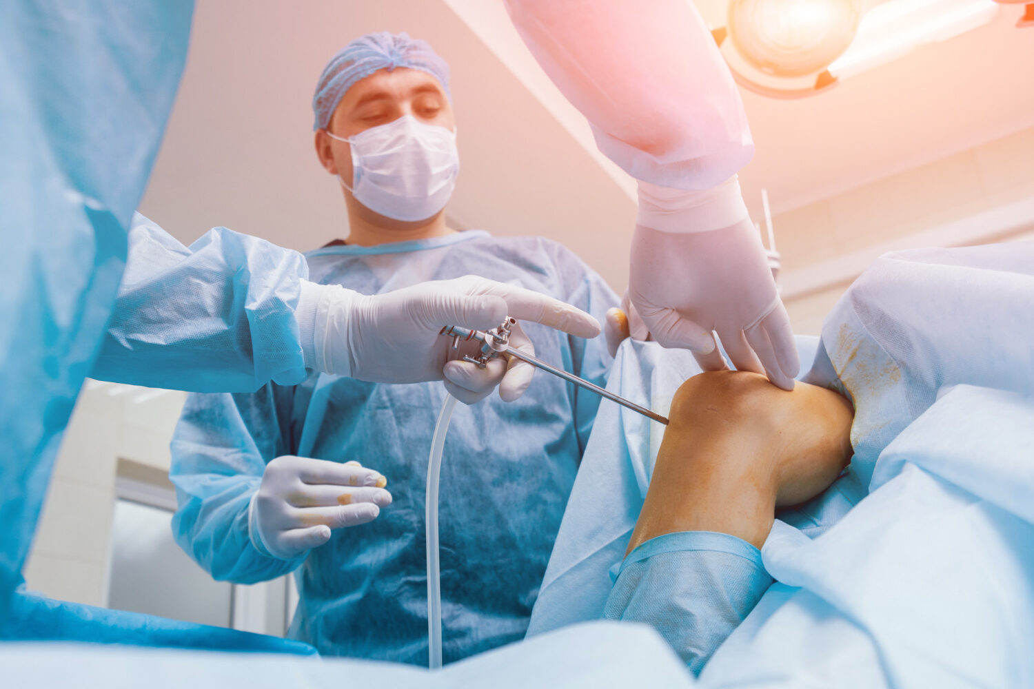 Arthroscopy